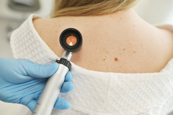 The Different Types of Skin Cancer Explained Simply