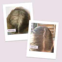 Hair Gain Capsules - 1 Month Supply