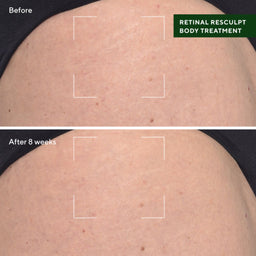 Murad Retinal ReSculpt Body Treatment