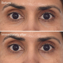 Retinol Youth Renewal Eye Mask - Single Pack