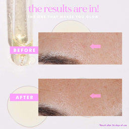 before and after