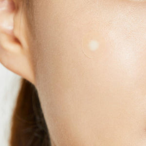 COSRX Acne Pimple Master Patch