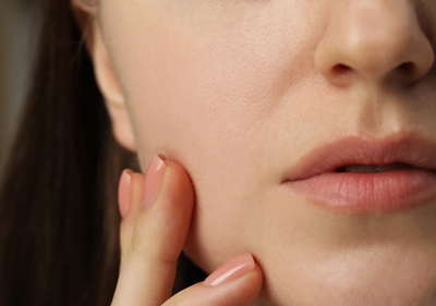 dehydrated skin products
