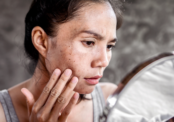 Our Top 10 Products For Treating Pigmentation