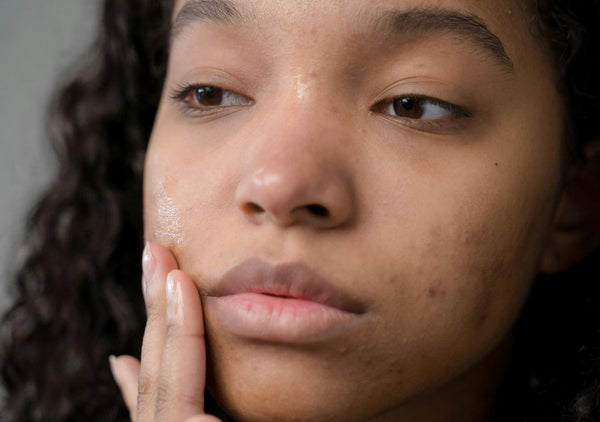 Introducing SOME BY MI Skincare: Natural Korean Skincare For Blemishes, Acne, And Unbalanced Skin
