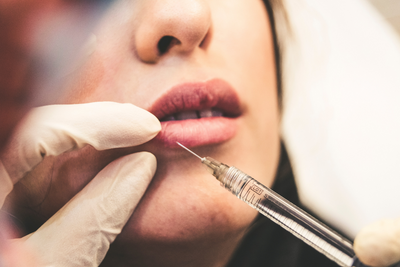 juvederm dermal filler