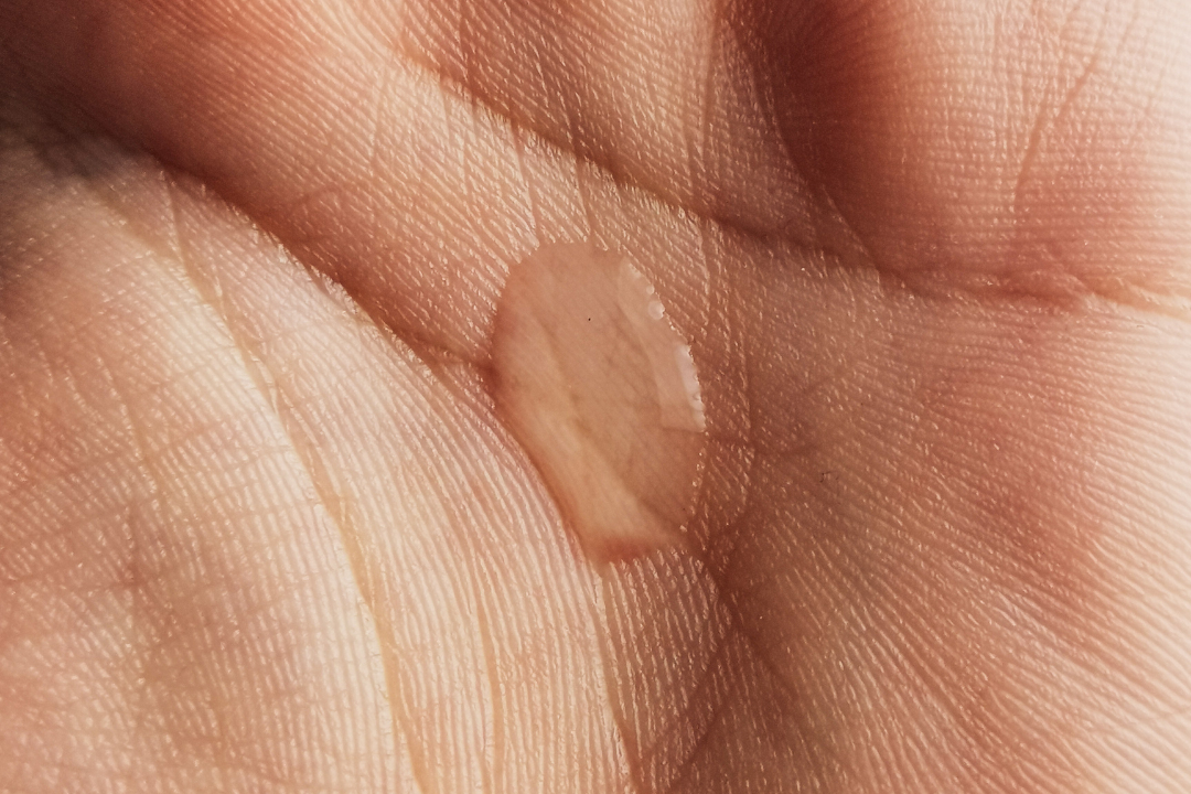 glycolic acid