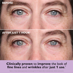 Peter Thomas Roth Instant FIRMx® Collagen Infusion Tightening Eye Patches 8 pairs