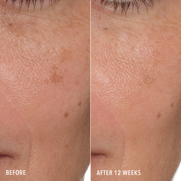 HydroPeptide Syner-C Before & After Tone & Texture
