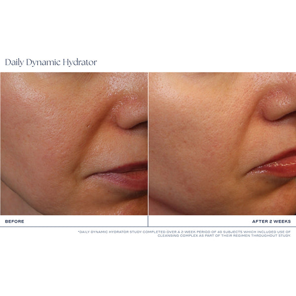 Before-and-after skin comparison showing the cheek and mouth area of a person using Daily Dynamic Hydrator, with visible improvement after 2 weeks.