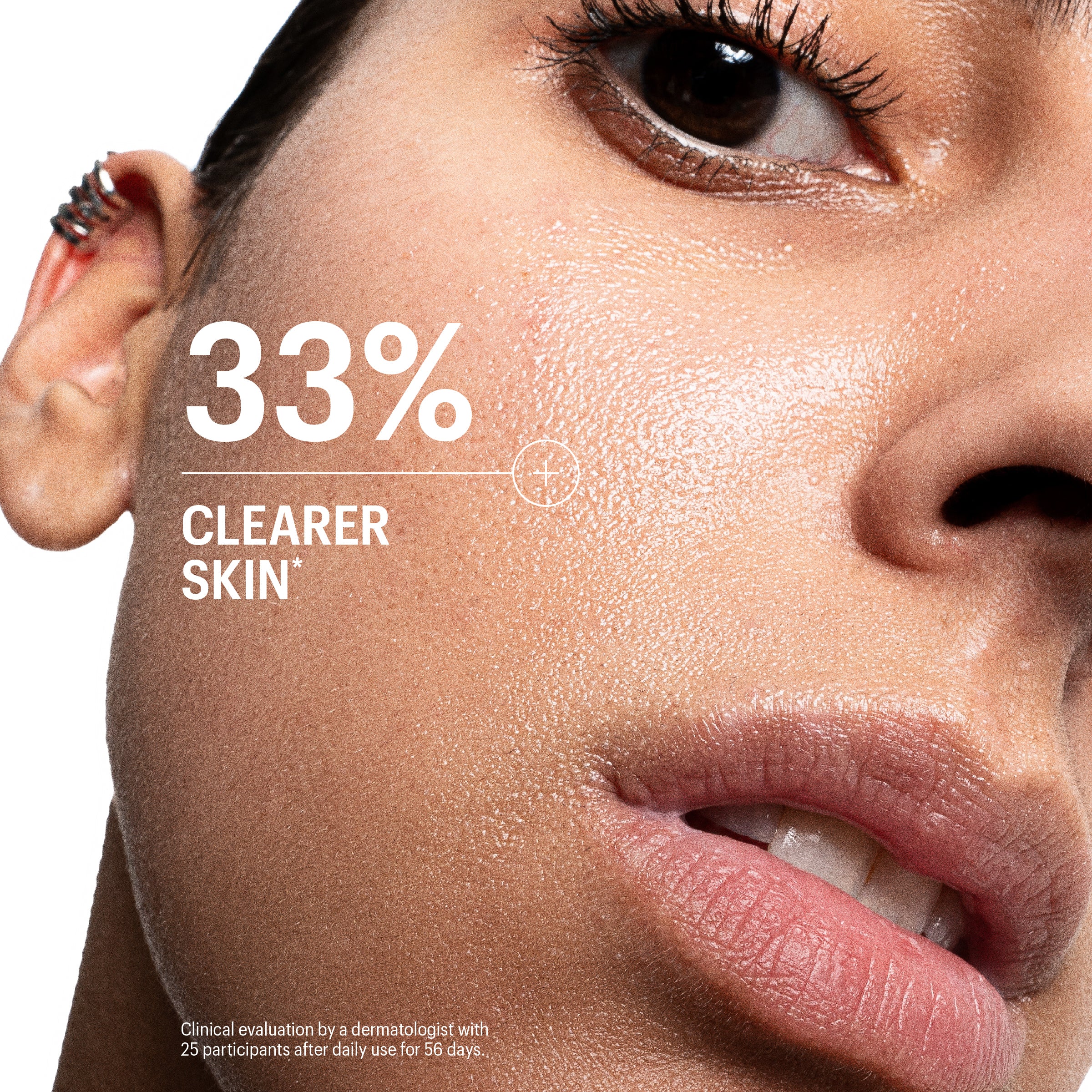TRIONA NcPA Advanced Serum 5本セット Allies of Skin Azelaic & Kojic Advanced Clarifying Serum | Face
