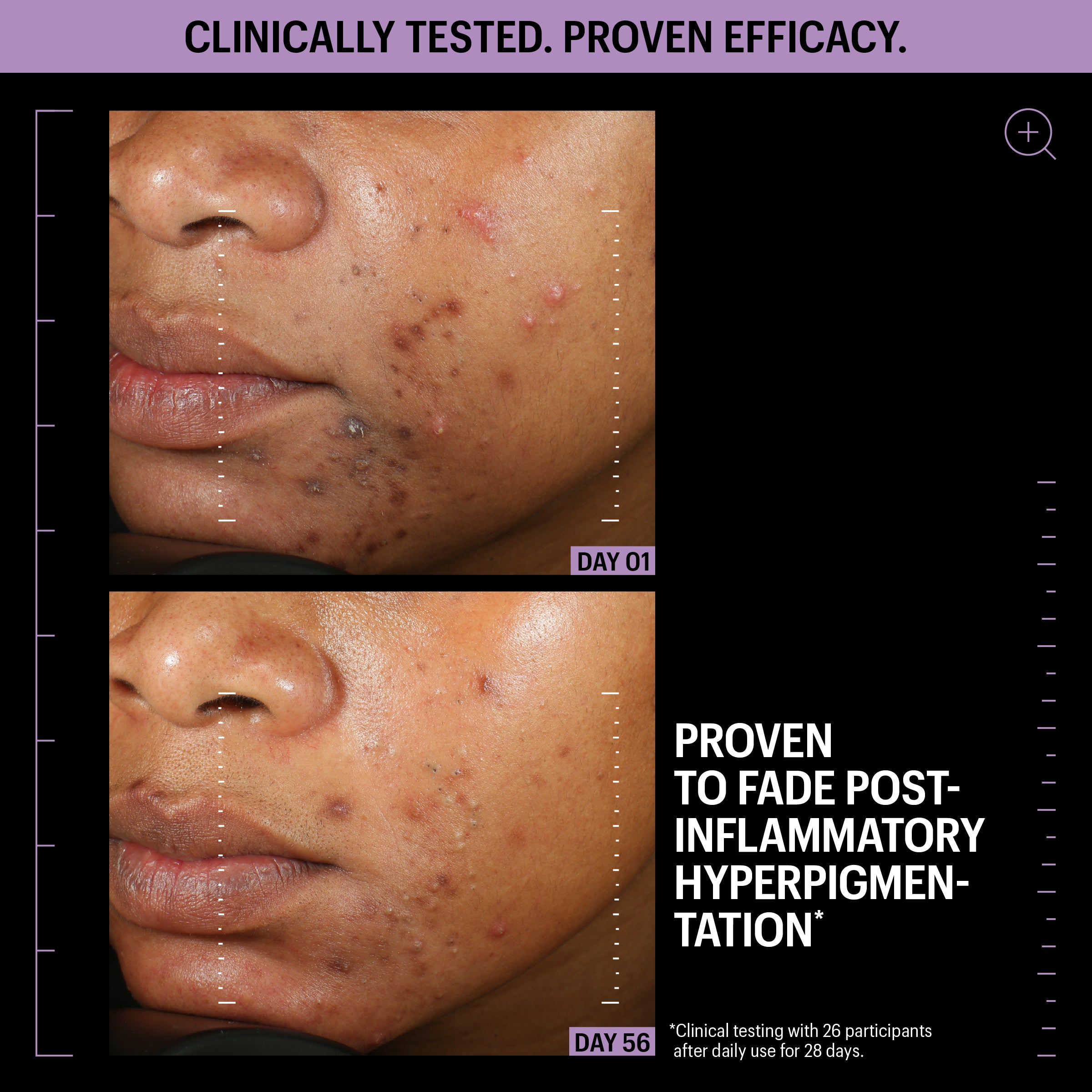Allies of Skin Azelaic & Kojic Advanced Clarifying Serum | Face