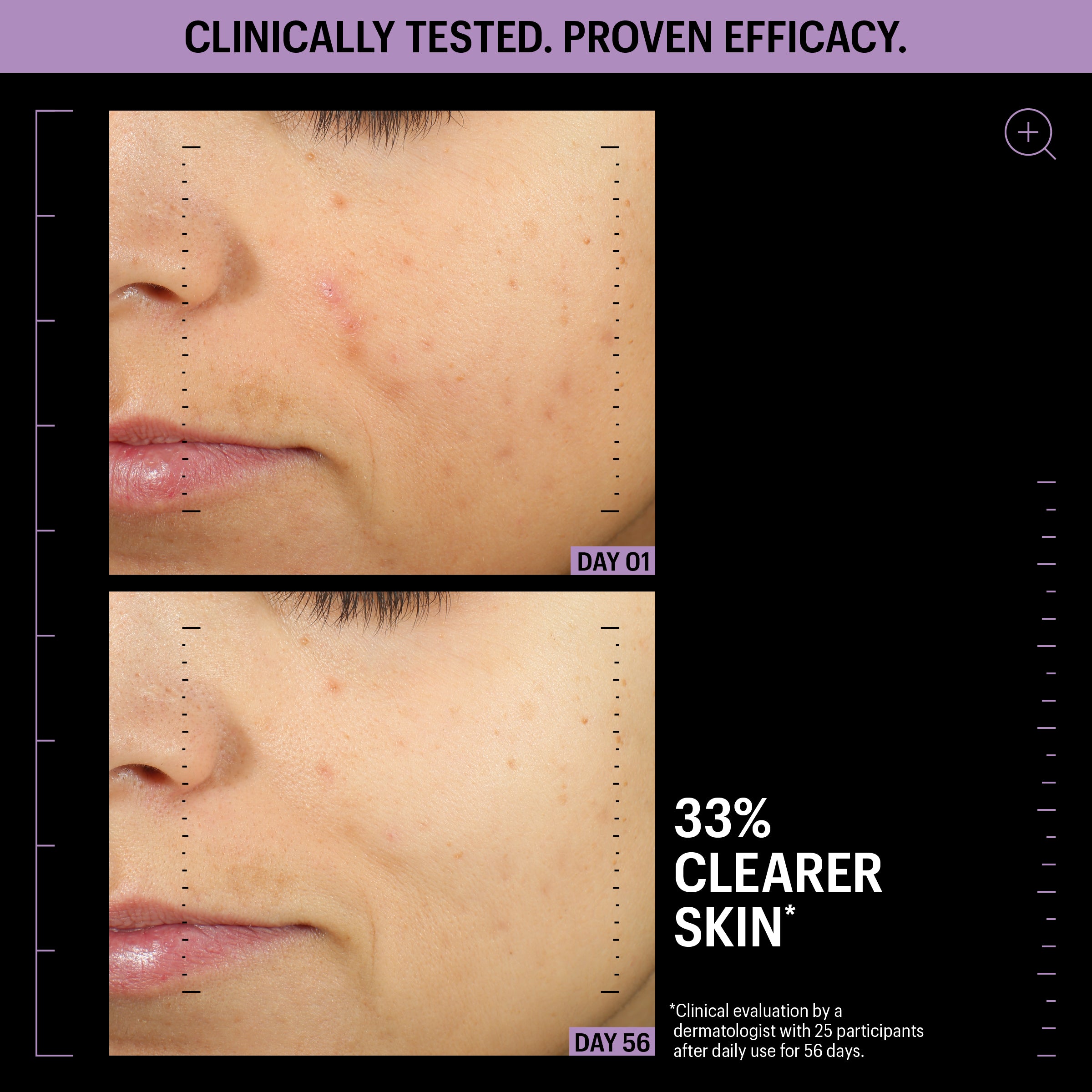 TRIONA NcPA Advanced Serum 5本セット Allies of Skin Azelaic & Kojic Advanced Clarifying Serum | Face