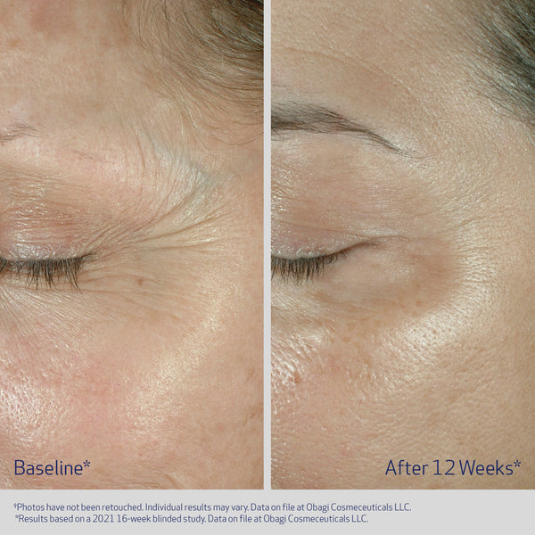 Obagi Elastiderm Eye Cream