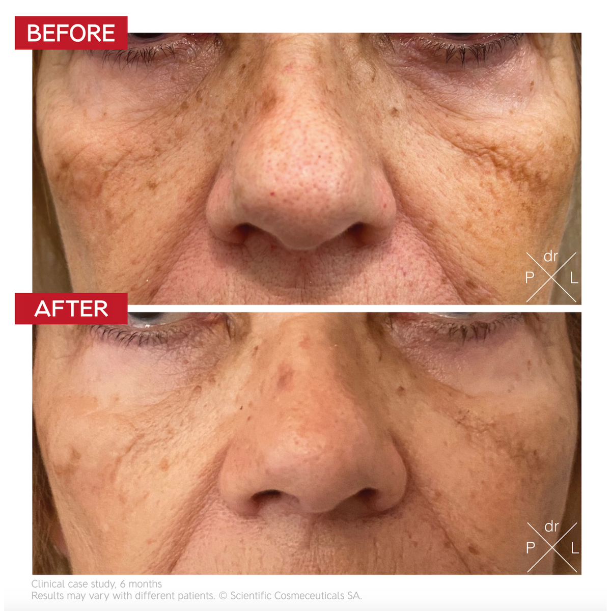 Dr Levy Pigment Control Drops 30ml