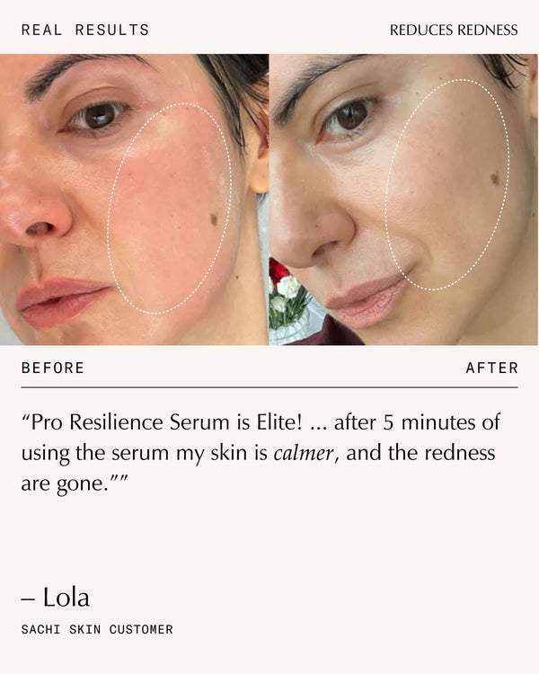 Sachi Skin Peptide Pro Resilience Serum Concentrate 30ml