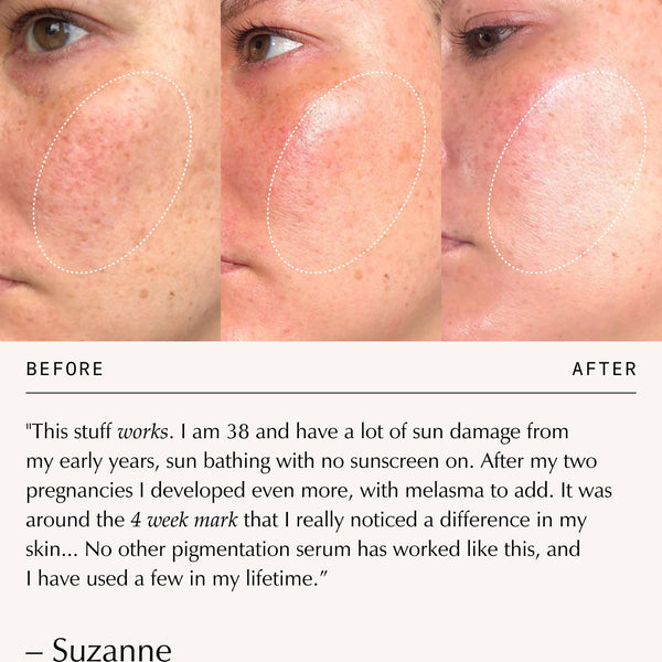 Sachi Skin Triphala Pigmentation Corrector 30ml