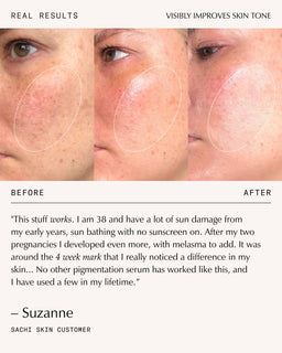 Sachi Skin Triphala Pigmentation Corrector 30ml