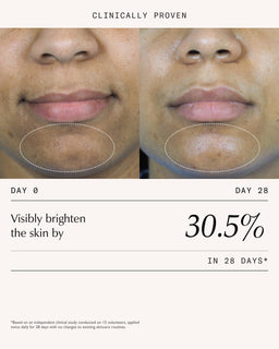 Sachi Skin Triphala Pigmentation Corrector 30ml