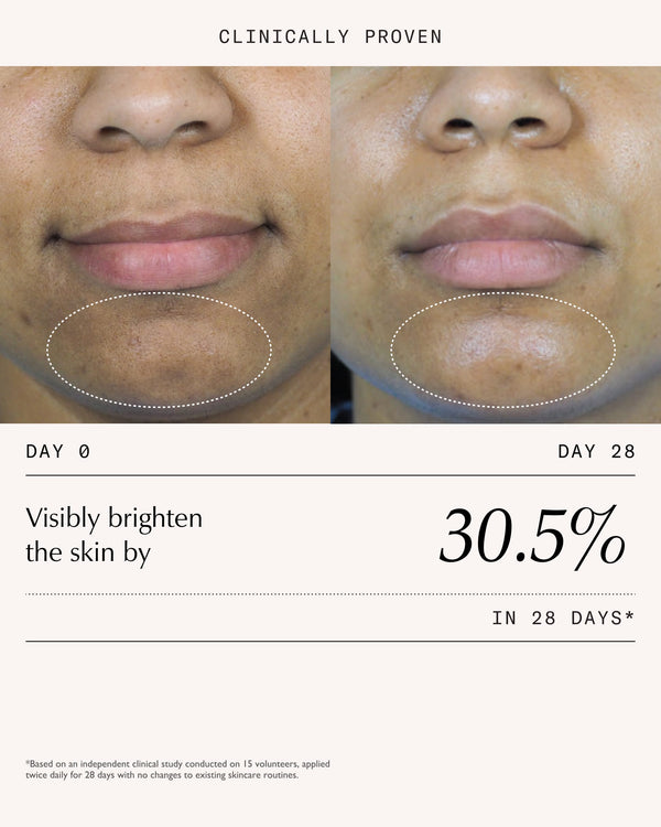Sachi Skin Triphala Pigmentation Corrector 30ml