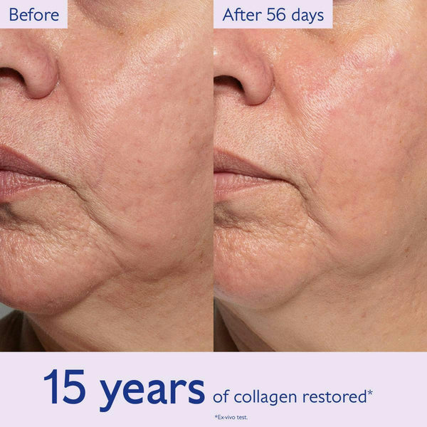 Before-and-after comparison of a person's lower face and jawline showing skin tightening after 56 days, with text reading 'Before', 'After 56 days', and '15 years of collagen restored'.