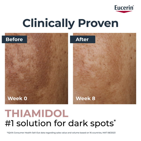 Eucerin Anti-Pigment Spot Corrector 5ml