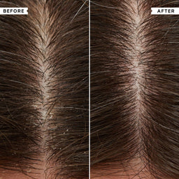 Philip Kingsley Flaky Itchy Scalp Conditioner