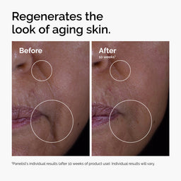 The Ordinary The Renewal Limited Edition Skincare Gift Set