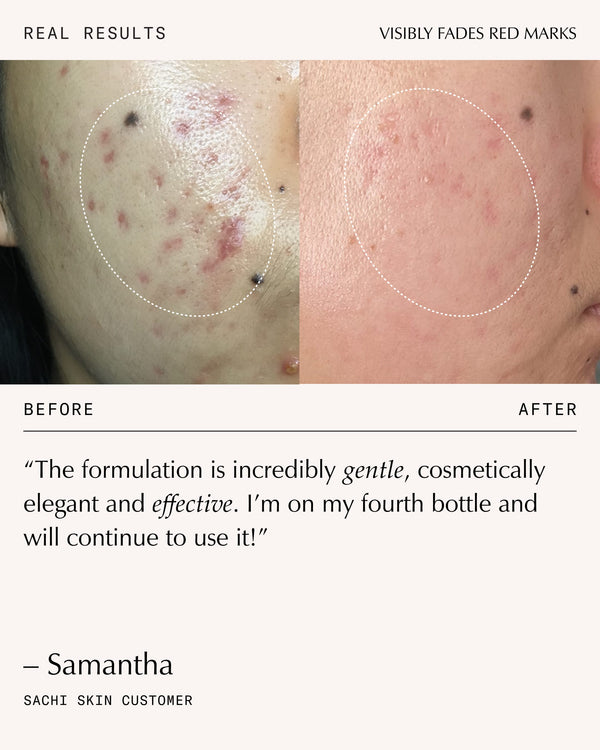 Sachi Skin Triphala Pigmentation Corrector 30ml