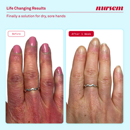 Nursem Caring Hand Cream Unfragranced 75ml
