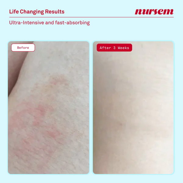 Nursem Ultra Caring Body Balm