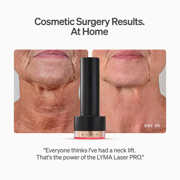 Before-and-after neck skin results with the LYMA Laser PRO cosmetic device centered in front of the images. Text reads 'Cosmetic Surgery Results.