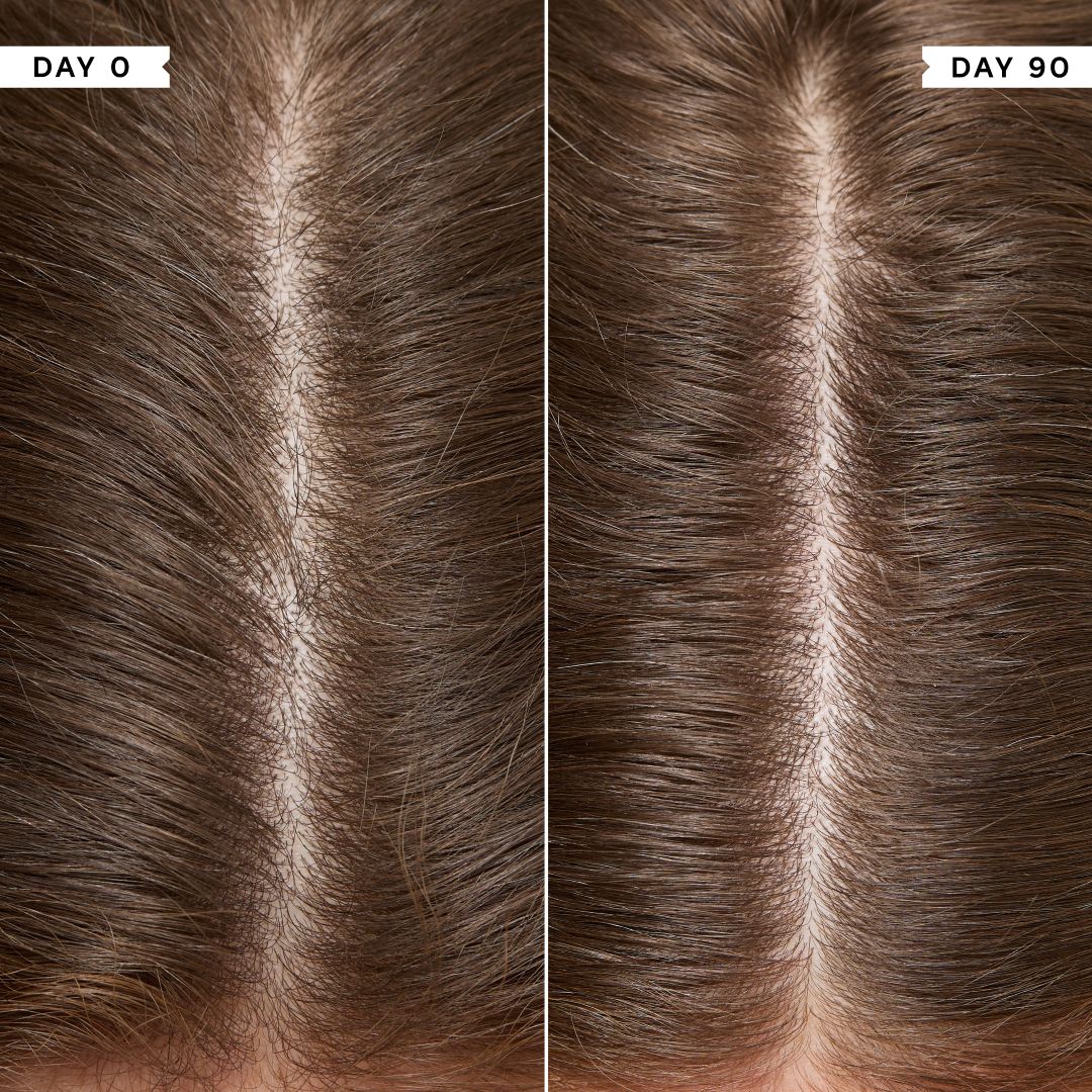 Philip Kingsley Density Scalp Drops