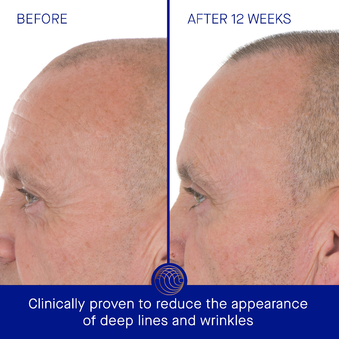 Before and after comparison of a man's face with text indicating clinical proven effects on deep lines and wrinkles.