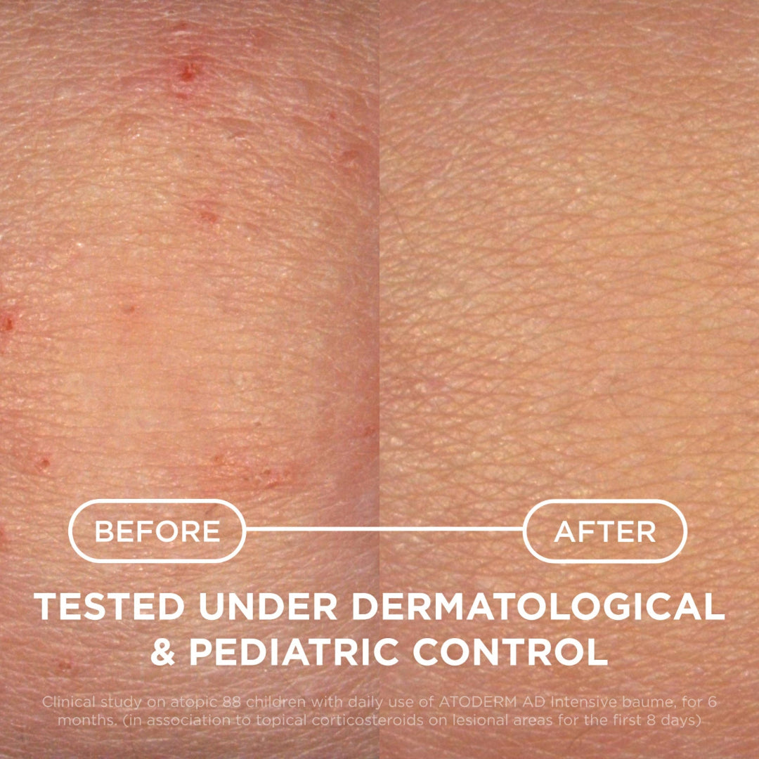 Before-and-after comparison of skin showing a reduction in redness and inflammation, with white text reading 'BEFORE', 'AFTER', and 'TESTED UNDER DERMATOLOGICAL & PEDIATRIC CONTROL'.