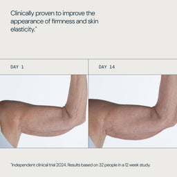 Before-and-after comparison of a human arm showing skin elasticity improvement, with text stating 'Clinically proven to improve the appearance of firmness and skin elasticity' and 'DAY 1' and 'DAY 14' labels.