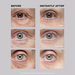 Peter Thomas Roth FIRMx Eye Duo Set