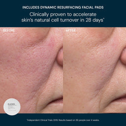 Elemis Glow Bright Resurfacing Trio