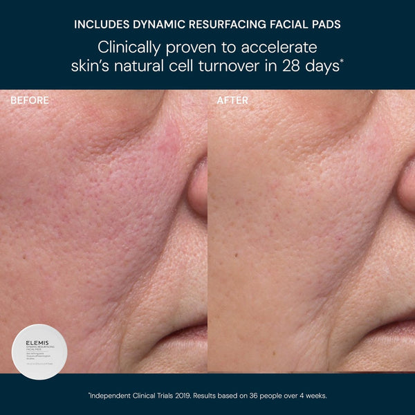 Elemis Glow Bright Resurfacing Trio