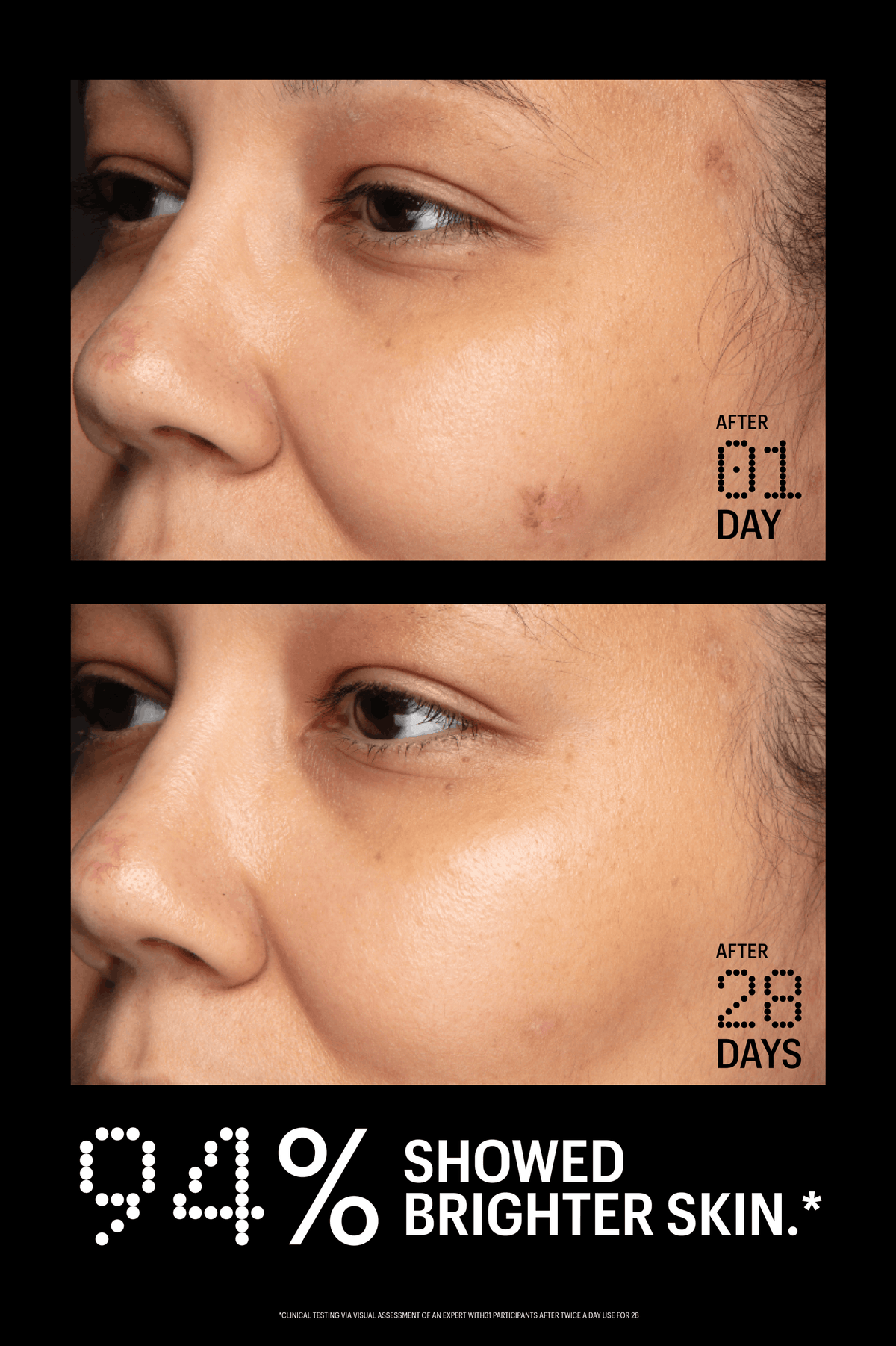 Before and after comparison of skin treatment showing improvement over 28 days.