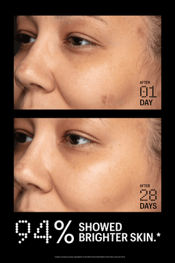 Before and after comparison of skin treatment showing improvement over 28 days.