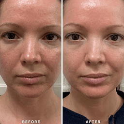 Alpha-H Vitamin B Serum 10ml