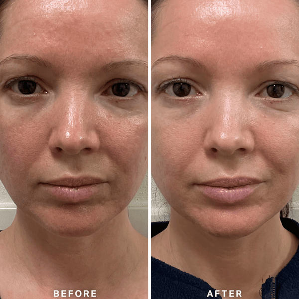 Alpha-H Vitamin B Serum 10ml