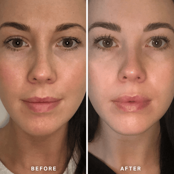 Alpha-H Vitamin B Serum 10ml