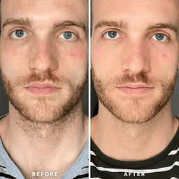 Alpha-H Vitamin B Serum 10ml