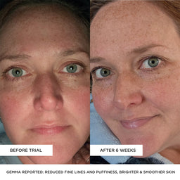 BEAUTYPRO LED Wand 5 In 1 Anti-Ageing Device