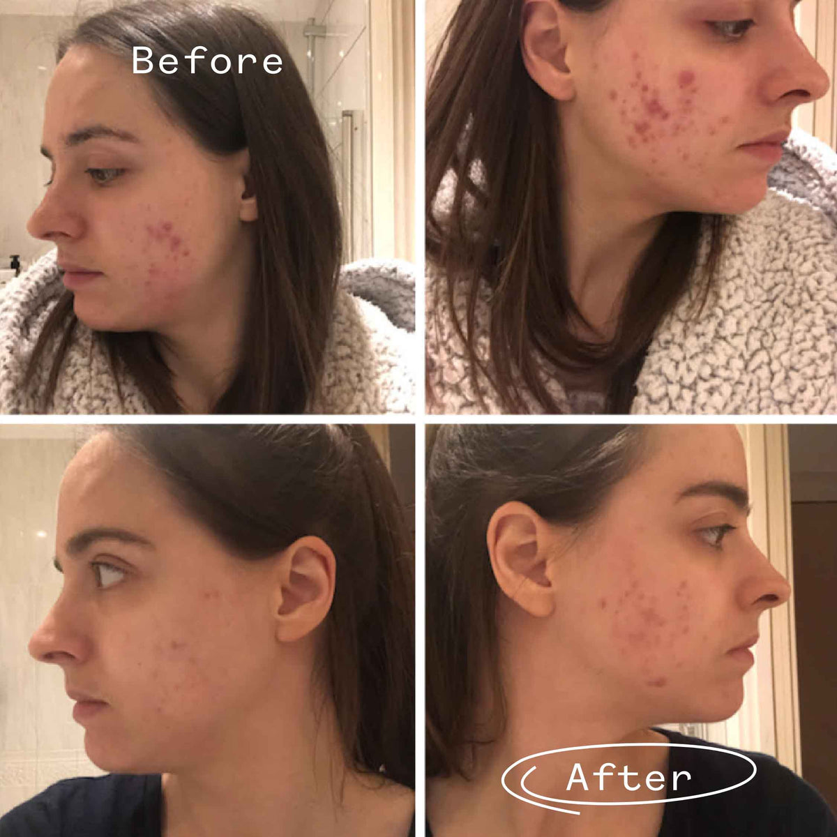 Pai Skincare Instant Kalmer Serum