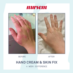 Nursem Skincare Discovery Set