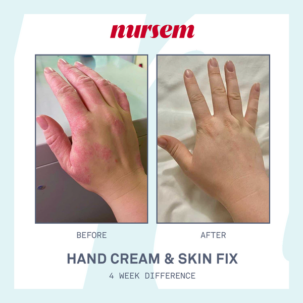 Nursem Skincare Discovery Set