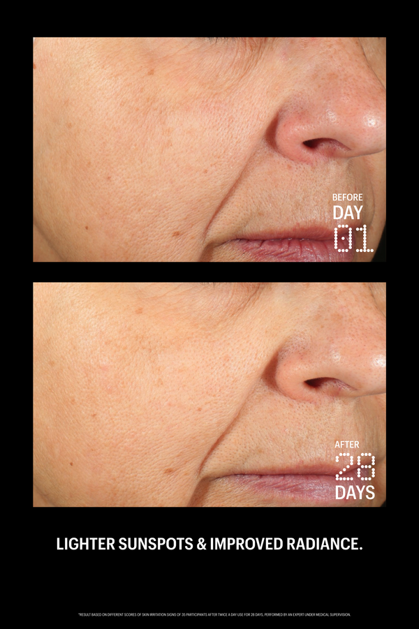 Before and after comparison of skin with sunspots and improved radiance on a black background.